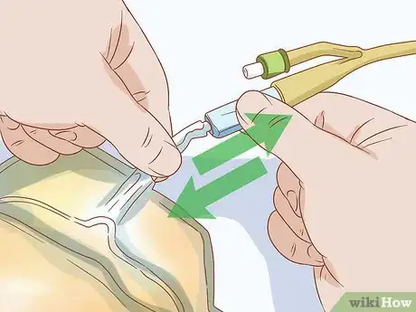 Imagen titulada Empty a Catheter Bag Step 10