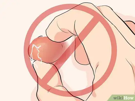 Imagen titulada Treat a Cyst Step 11