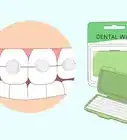 besar con brackets