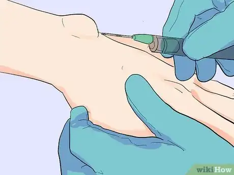 Imagen titulada Treat a Cyst Step 20