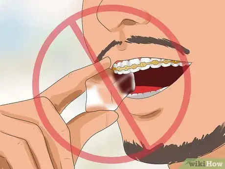 Imagen titulada Get Your Braces off Faster Step 10