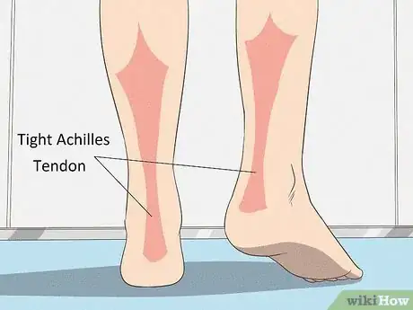 Imagen titulada Fix Flat Feet Step 2