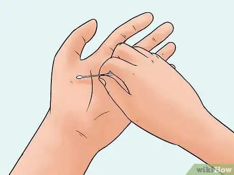 Imagen titulada Remove a Pin or Tack from Your Skin Step 6