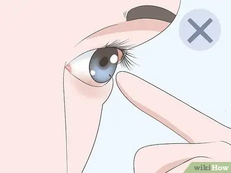 Imagen titulada Get Sand Out of Your Eyes Step 13