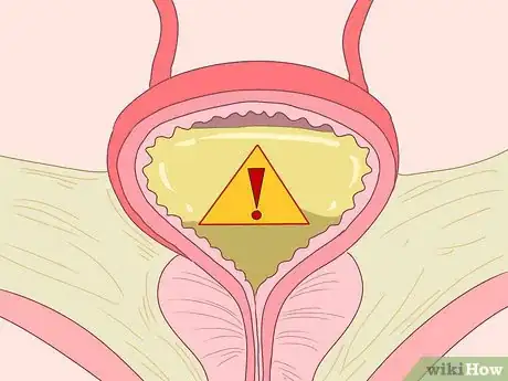 Imagen titulada Reduce Protein in Urine Step 4