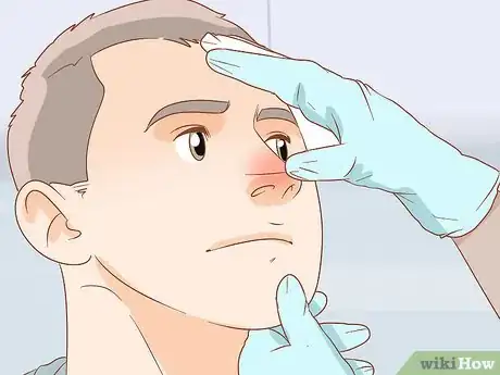 Imagen titulada Reduce Nose Swelling Step 14