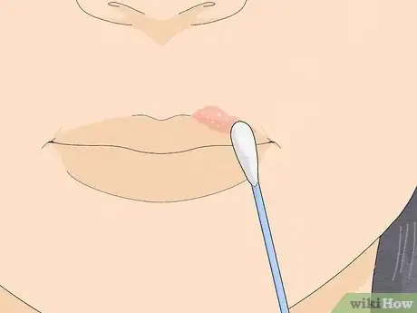 Imagen titulada Use Tea Tree Oil Step 7