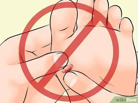 Imagen titulada Treat a Blood Blister Step 3