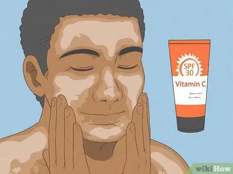 Imagen titulada Get Rid of Dry Skin Step 9