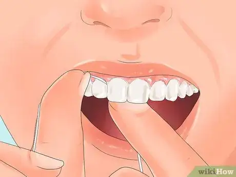 Imagen titulada Get Pink Gums Step 9