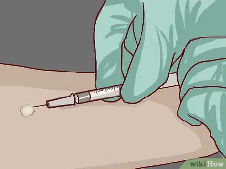 Imagen titulada Read a Tuberculosis Skin Test Step 1