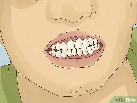 Imagen titulada What Does Teeth Falling Out in a Dream Mean Step 2