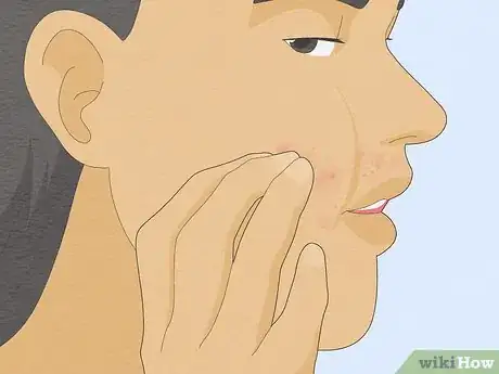 Imagen titulada Treat a Face Rash After Waxing Step 7