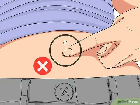 Imagen titulada Treat an Irritated Belly Button Piercing Step 9
