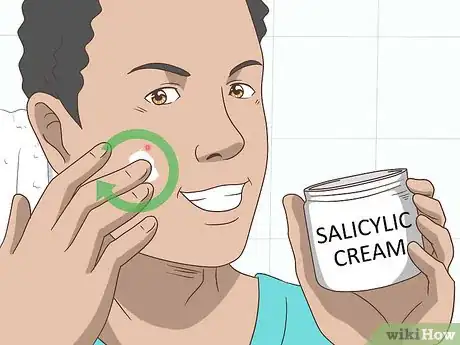 Imagen titulada Get Rid of a Pimple Step 4