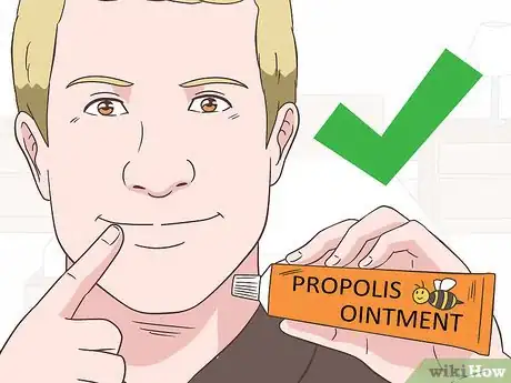 Imagen titulada Prevent a Cold Sore from Forming Step 15