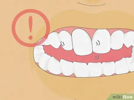 Imagen titulada Make a Fake Retainer Out of Wax Step 1