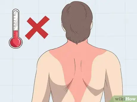 Imagen titulada Heal a Pulled Trapezius Muscle Step 11