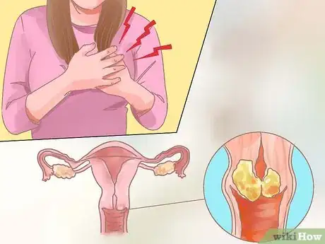 Imagen titulada Balance Hormones for Acne Step 3