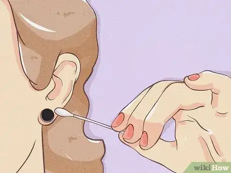 Imagen titulada Gauge Your Ears Step 14