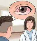 quitar lentes de contacto pegados