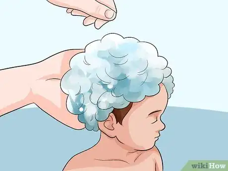 Imagen titulada Easily Clean Baby's Cradle Cap Dandruff Without Hurting the Baby Step 6