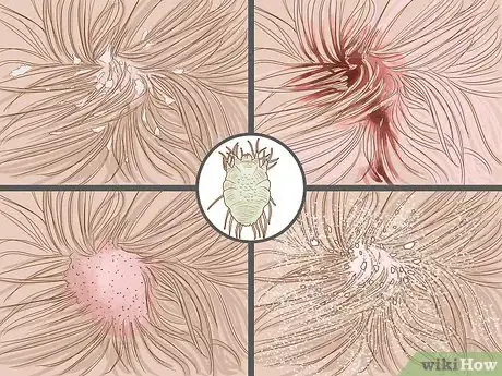 Imagen titulada Diagnose and Treat Your Dog's Itchy Skin Problems Step 8