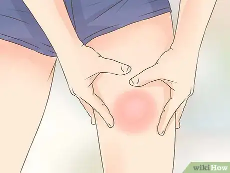 Imagen titulada Give Yourself Insulin Step 30
