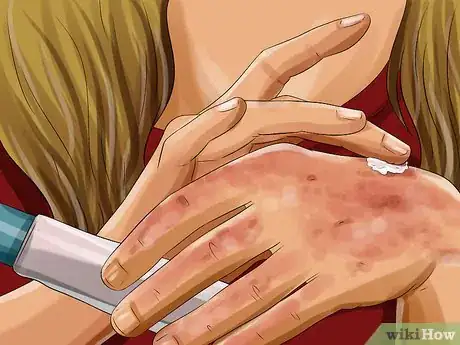 Imagen titulada Apply Witch Hazel to Your Face Step 15