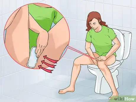Imagen titulada Care for an Episiotomy Postpartum Step 6