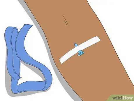 Imagen titulada Insert an IV Step 13