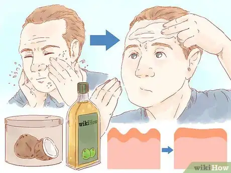 Imagen titulada Get Rid of Forehead Wrinkles Step 7