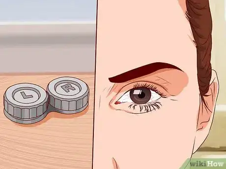 Imagen titulada Make Your Eyes Red Step 13