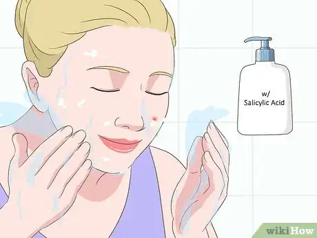 Imagen titulada Stop a Pimple from Forming Step 3