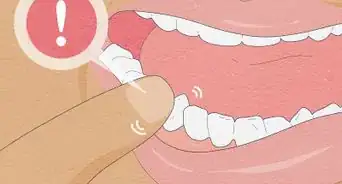 sacarse un diente flojo en casa