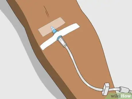 Imagen titulada Insert an IV Step 14