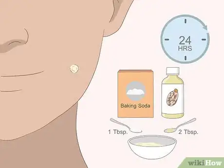 Imagen titulada Remove Moles Quickly Step 14