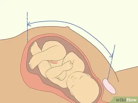 Imagen titulada Measure Fundal Height Step 6