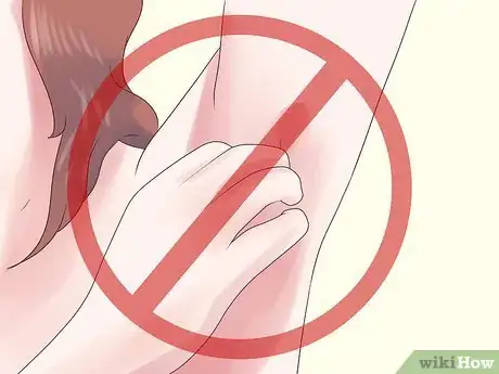 Imagen titulada Heal Armpit Rash Step 9