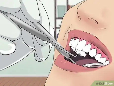 Imagen titulada Deal With Buck Teeth Step 2