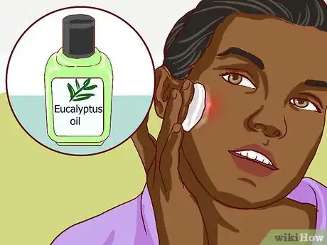 Imagen titulada Stop Recurring Boils Step 12