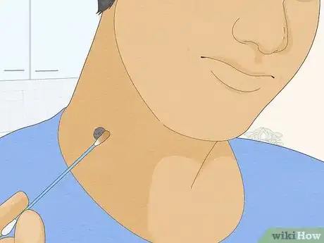 Imagen titulada Remove a Mole with Iodine Step 10