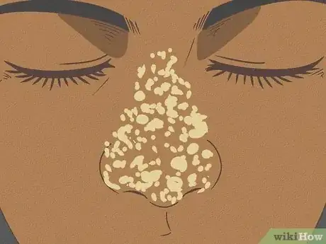 Imagen titulada Clean Nose Pores Step 1