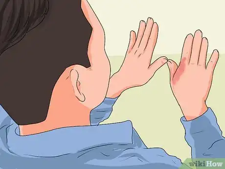 Imagen titulada Treat a Hand Burn Step 9