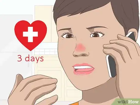 Imagen titulada Treat a Broken Nose Step 11