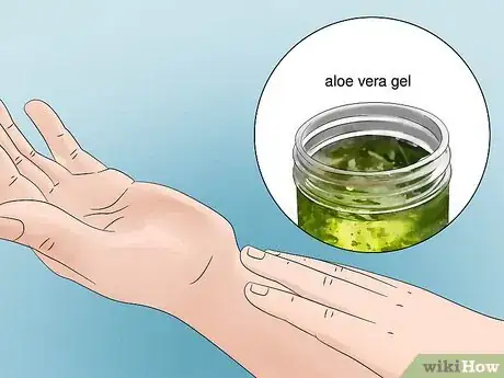 Imagen titulada Treat Flea Bites Step 6