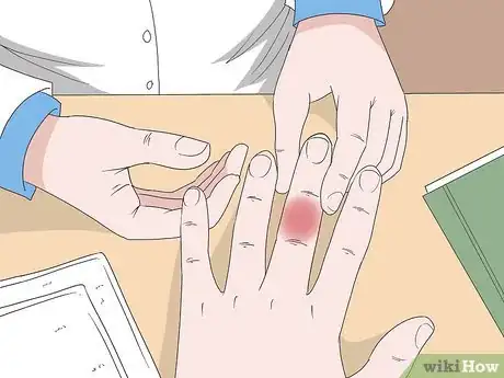 Imagen titulada Cure an Infected Finger Step 8