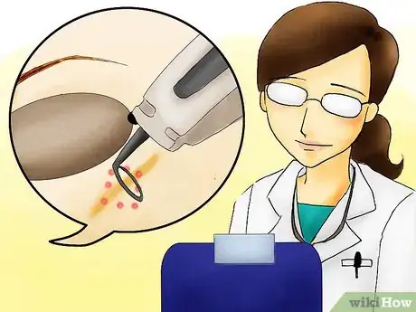 Imagen titulada Soften Facial Scars Step 06