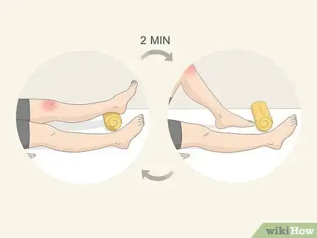 Imagen titulada Recover from an MCL Sprain Step 6