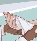 saber si tu nudillo está roto